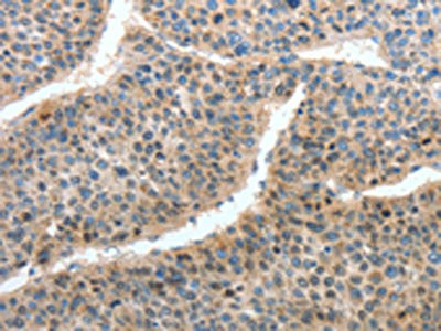 Anti-HTR3A