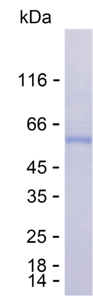 Recombinant Human ANKRD13A Protein