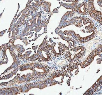 Anti-CAMKK2 / Calcium/calmodulin-dependent protein kinase kinase 2