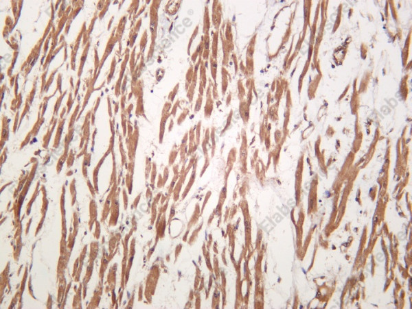 Anti-Recombinant PDE3A, clone C112366
