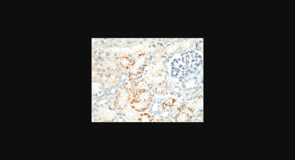 Anti-Ki 67, monoclonal