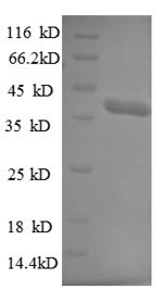 E3 ubiquitin-protein ligase TRIM11 (TRIM11), partial, human, recombinant