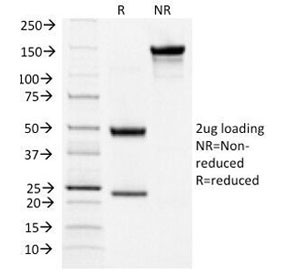 Anti-Thyroid Stimulating Hormone Receptor / TSHR (beta chain), clone TSHRB/1404