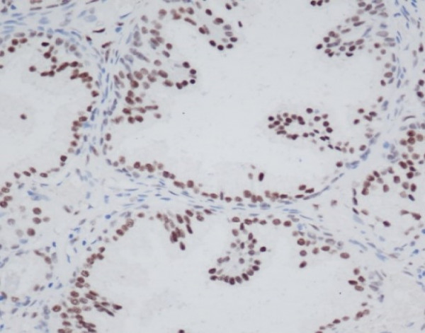 Anti-Androgen Receptor, clone SQab1729