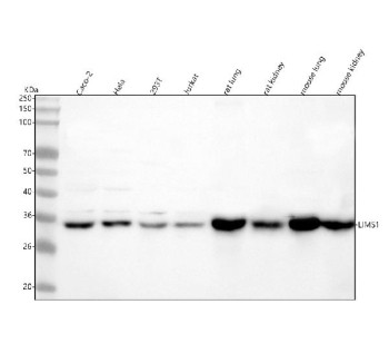 Anti-LIMS1 / LIM and senescent cell antigen-like-containing domain protein 1