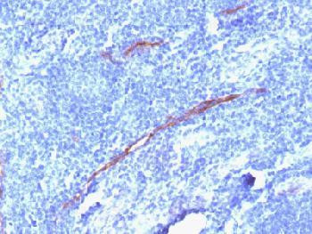 Anti-CD34 (Hematopoietic Stem Cell &amp; Endothelial Marker) (clone: HPCA1/1806R) (recombinant rabbit mo