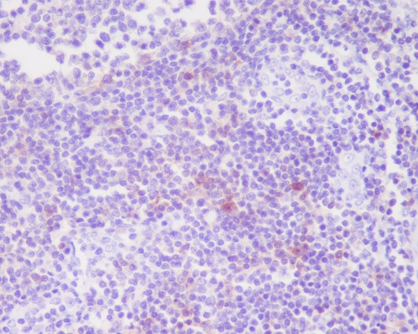 Anti-IL-2 Receptor alpha (recombinant antibody)
