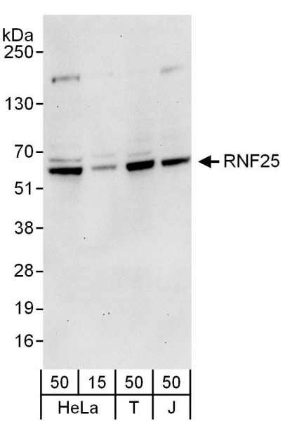 Anti-RNF25