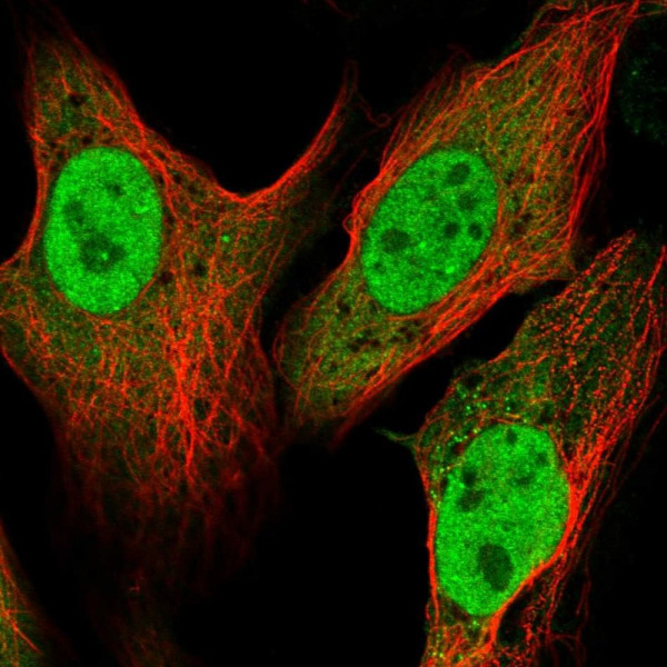 Anti-ATP6V1C1