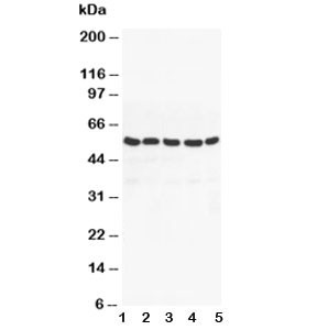 Anti-PPAR gamma