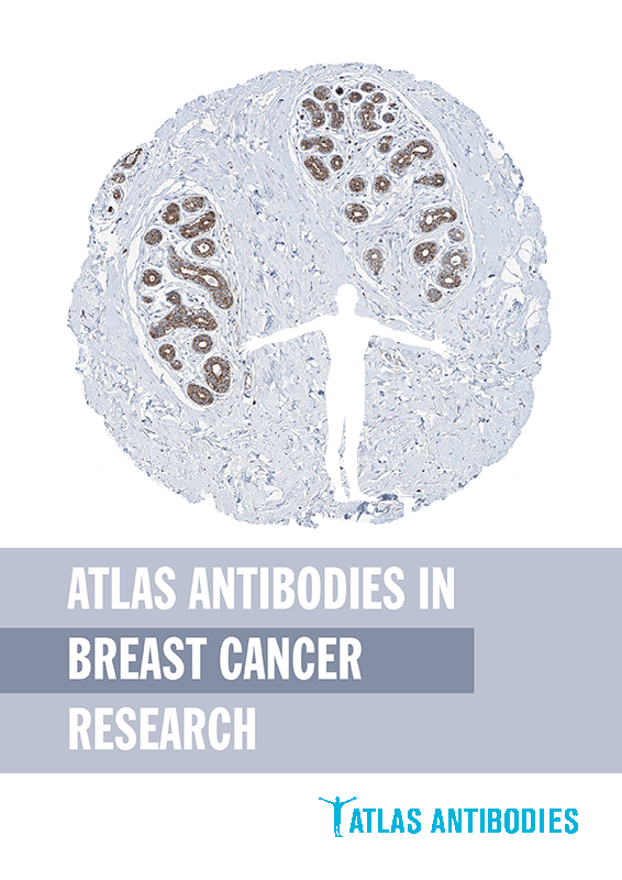 Atlas Antibodies in Breast Cancer Research