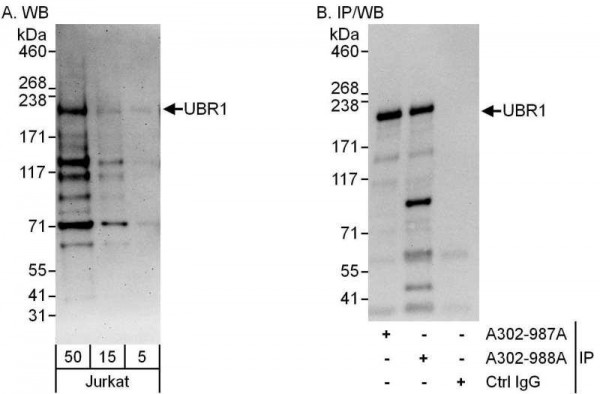 Anti-UBR1