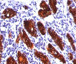 Anti-Thyroglobulin, clone 2H11