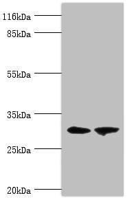 Anti-ACBD4