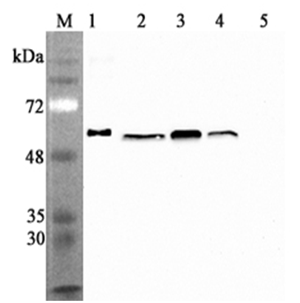 Anti-Calreticulin (human), clone CR213-2AG