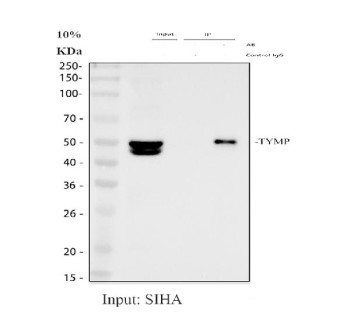 Anti-TYMP / Thymidine phosphorylase / PD-ECGF