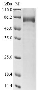 Sclerostin (Sost), rat, recombinant