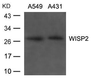 Anti-WISP2