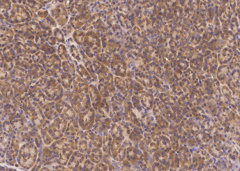 Anti-PMVK/phosphomevalonate kinase Monoclonal Recombinant Antibody
