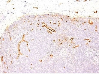 Anti-von Willebrand Factor / vWF, clone VWF635