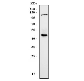 Anti-KCNN4 / KCa3.1 / SKCa4