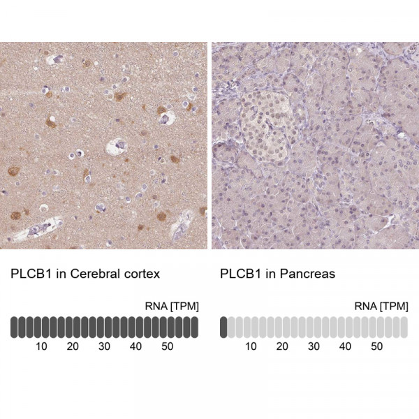 Anti-PLCB1