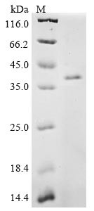 CCN family member 1 (Ccn1), mouse, recombinant
