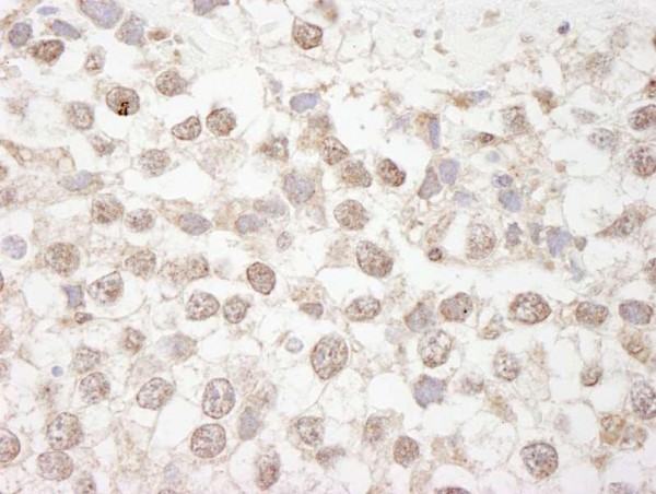Anti-MBD4 (IHC)