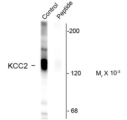 Anti-phospho-KCC2 / Potassium Chloride Cotransporter (Ser940)