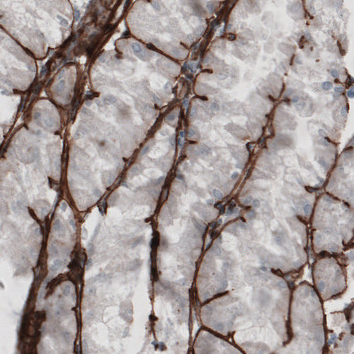 Anti-LAMC1, clone CL3201