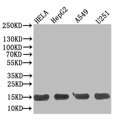 Anti-TNFRSF10B, recombinant clone 11E11