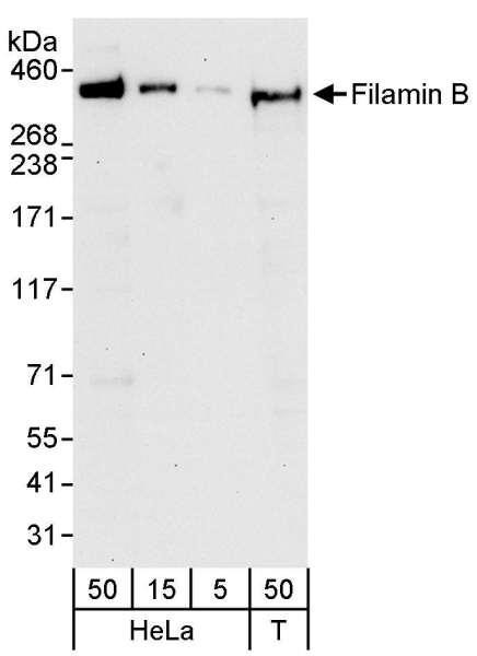 Anti-Filamin B