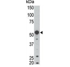 Anti-BLK / B lymphocyte kinase