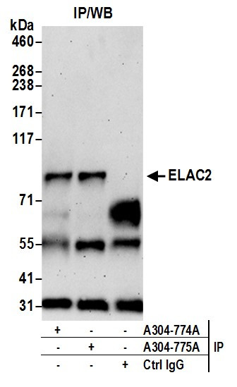 Anti-ELAC2