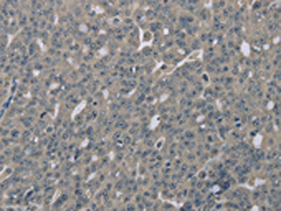 Anti-EDN1