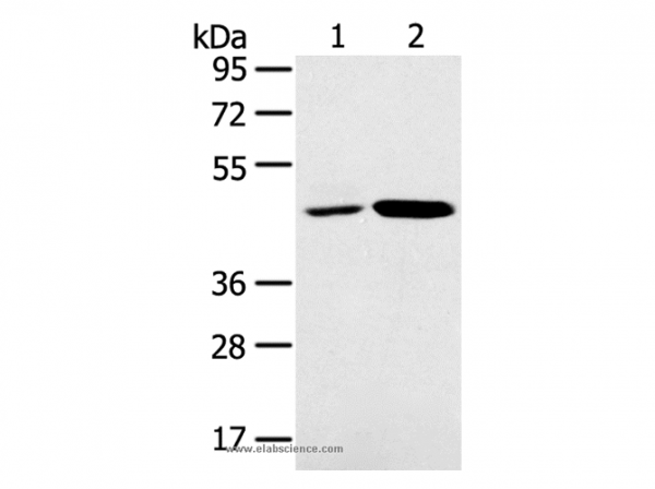 Anti-SNX5
