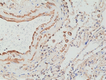 Anti-MMP12 (recombinant antibody), clone RM381
