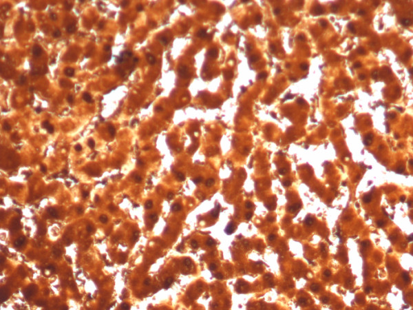 Anti-Arginase 1 (Hepatocellular Carcinoma Marker), recombinant antibody, clone ARG1/7514R