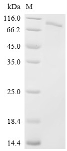Envelopment polyprotein (GP), partial, Crimean-Congo hemorrhagic fever virus, recombinant