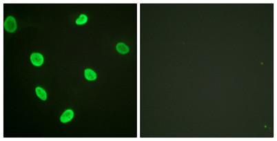 Anti-acetyl-Acetyl Histone H2B (Lys12)