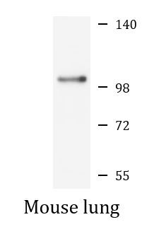 Anti-KPNB1