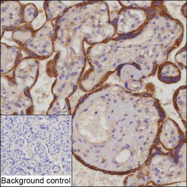 Anti-SCYL3