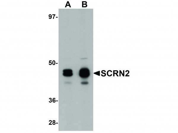 Anti-SCRN2