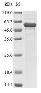Steroidogenic factor 1 (NR5A1), partial, human, recombinant