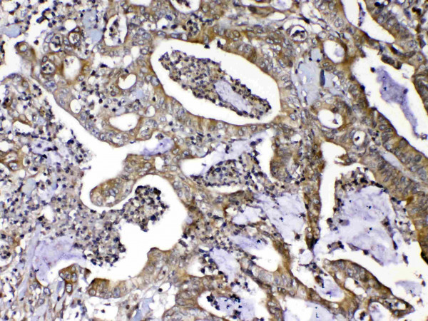 Anti-MMP16