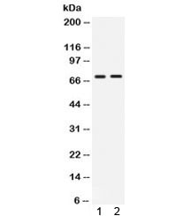 Anti-cIAP2 / BIRC3