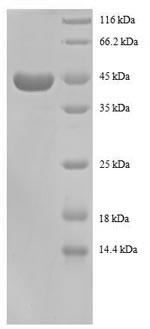 40S ribosomal protein S13 (RPS13), partial, human, recombinant