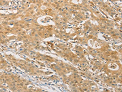Anti-PGK2