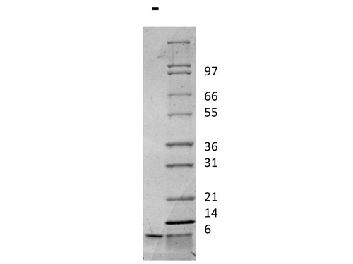 Insulin-like Growth Factor I