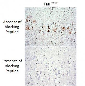 Anti-phospho-Tau (Thr217)